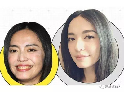 牙齿又黄又黑怎么能变白?抽烟牙齿很黑怎么办?冷光美白仪多少钱?冷光美白仪对牙齿有害吗?